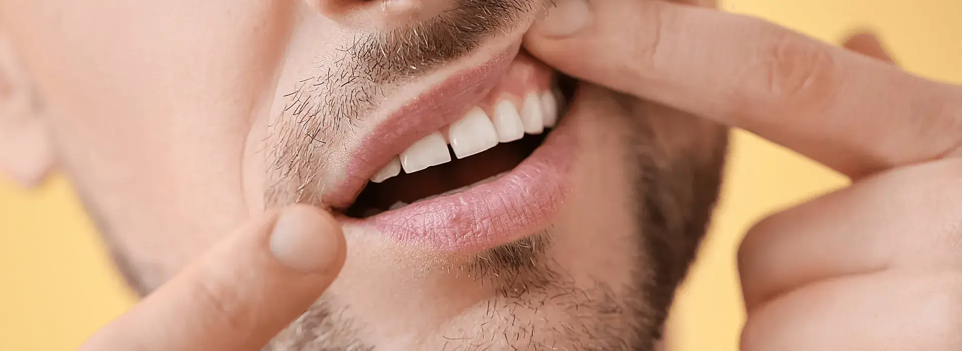 Gum Disease